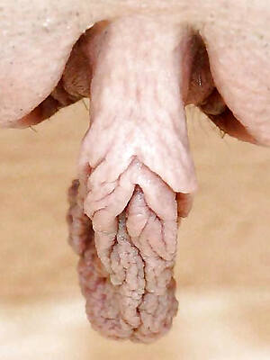 mature vulva pic